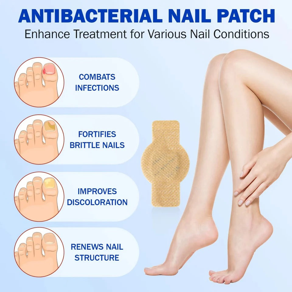Fungal Nail Patches