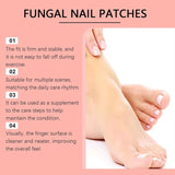 Fungal Nail Patches