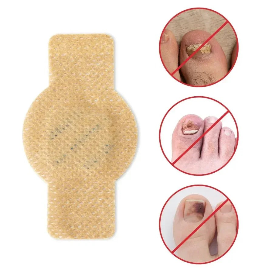 Fungal Nail Patches
